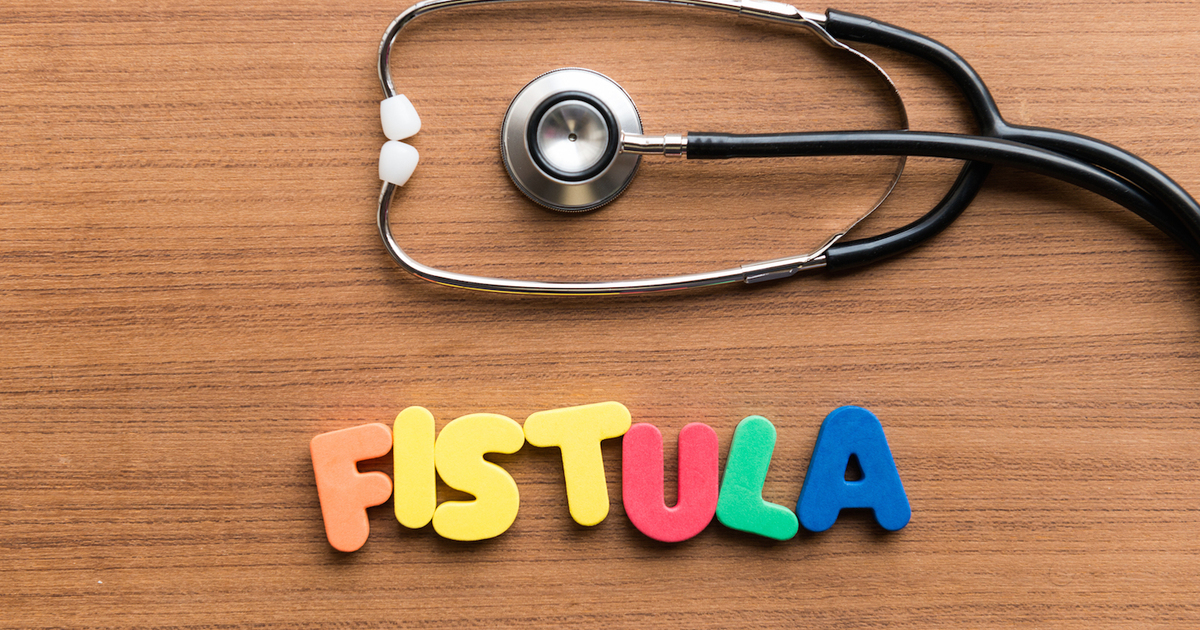 fistula symptoms